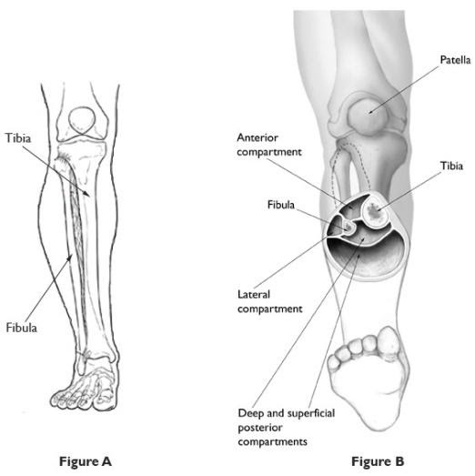 Compartment Syndrome - Advance Foot Clinic Podiatry