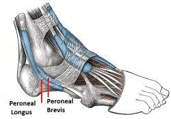 Peroneal-Tendonitis