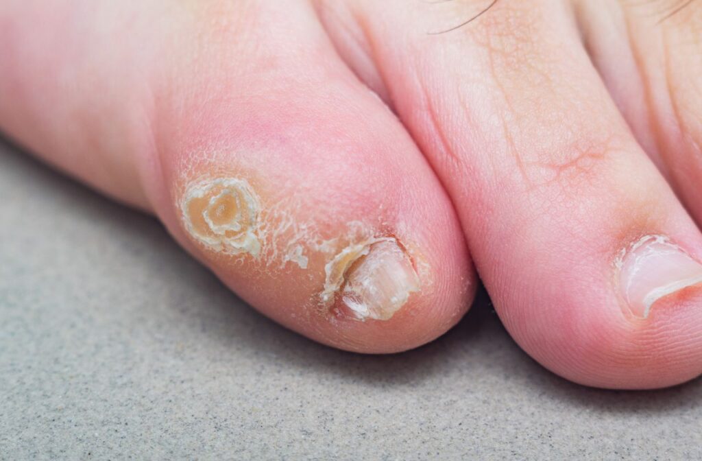 5 Common foot health issues