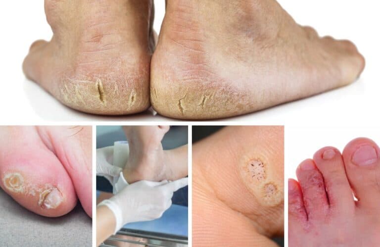 5 skin conditions podiatrists treat