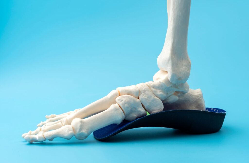 orthotics can improve running by realignment joints for more efficient use of muscles