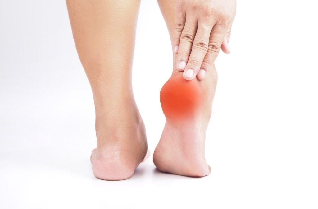 plantar fasciitis is a common cause of foot pain in tradies