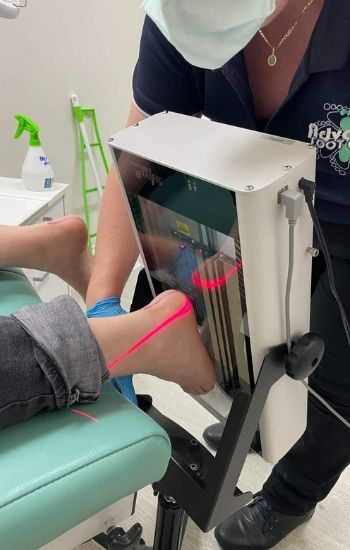Getting Custom Orthotics - Advance Foot Clinic Podiatry