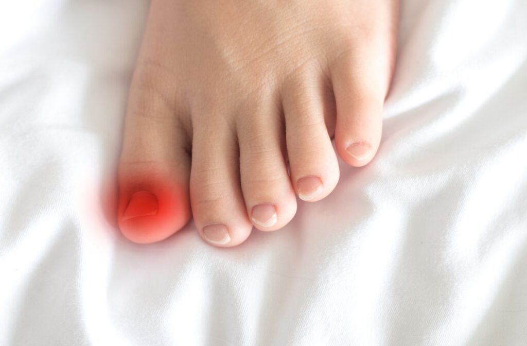 ingrown nails are best treated by a podiatrist who can surgically or conservatively fix the ingrown nail