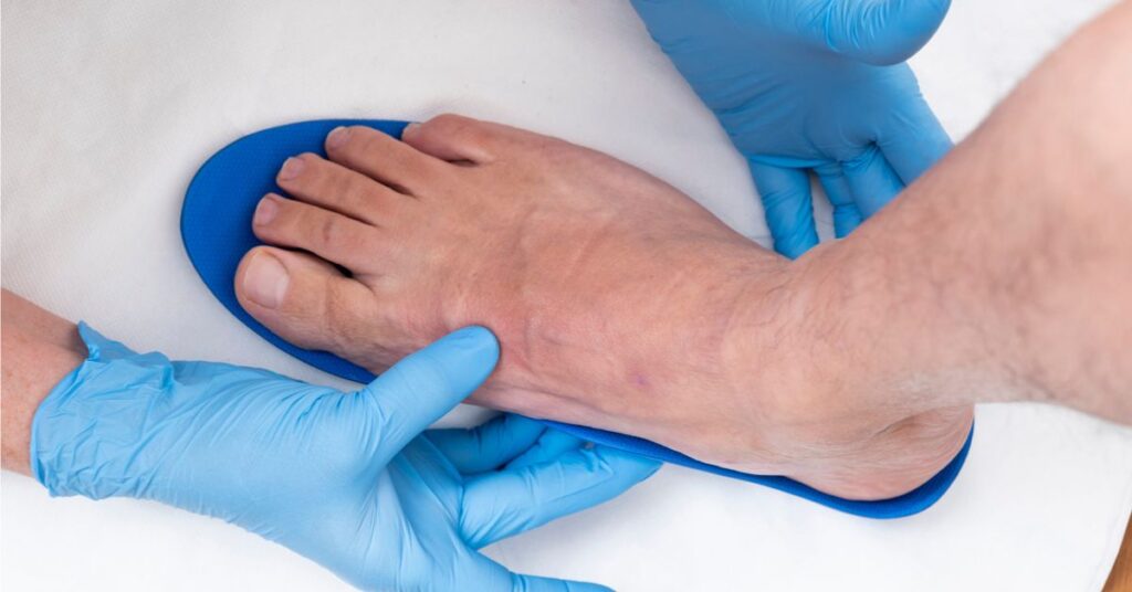 Podiatrist fitting custom orthotic to a foot