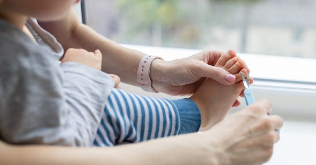 Ingrown toenail in young infant